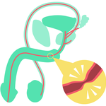 STRONG-UR_male stricture.png